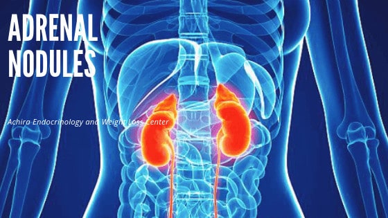 Adrenal Nodules